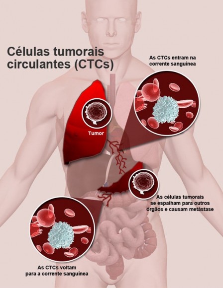 Imagem: ctc Novo exame consegue detectar células cancerígenas no sangue