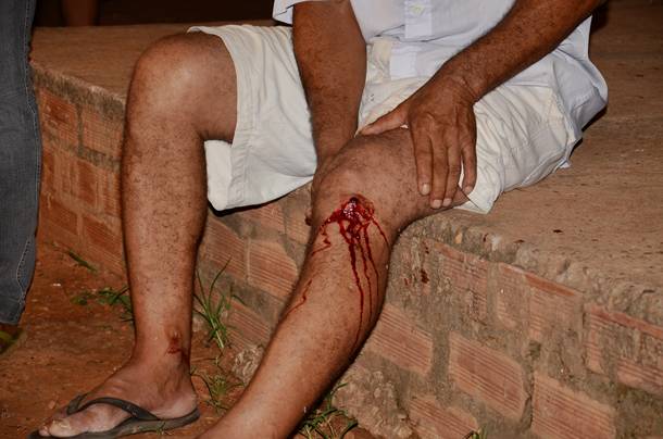 Imagem: PM homem baleado na vila Taiti 03