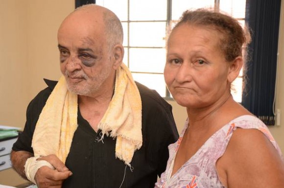 O casal de idosos ficou bastante machucado-Foto:Varlei Cordova/AGORA MT