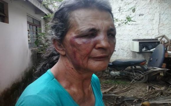 Idosa mostra as marcas da agressão da irmã - foto: José Antonio Araujo / AGORA MT