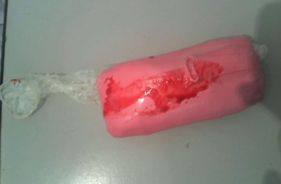 Sangrou ao retirar o objeto da vagina - Foto: AGORA MT