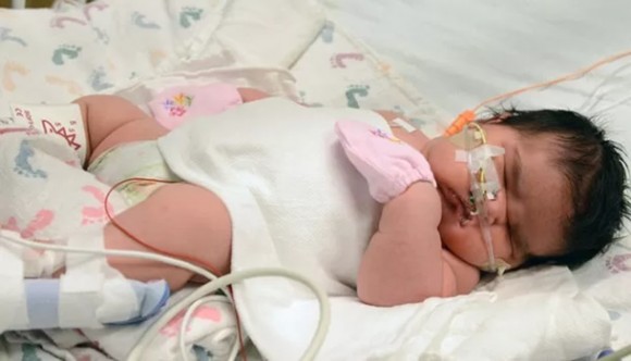 Mia Yasmin Garcia nasceu com 6,26 kg (Foto: Children’s Hospital Colorado, Tia Brayman/AP)