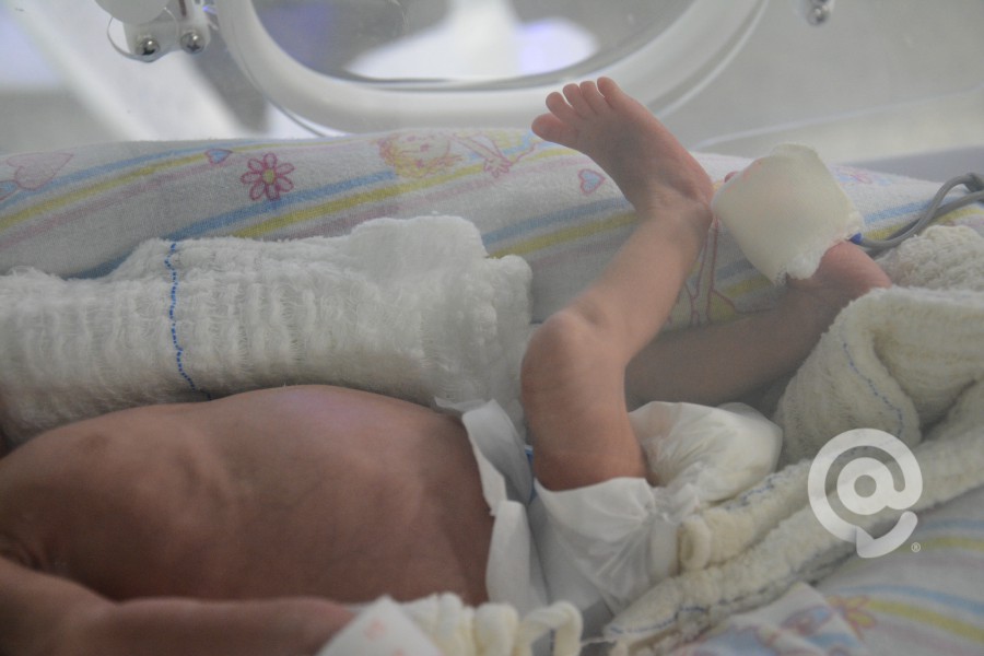 Um dos bebês internados na UTI - Foto: Varlei Cordova / AGORA MT