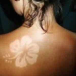 Mulher exibe "tatuagem" de flor adquirida por meio da Sunburn Art - Foto: @hotbarnaul / Instagram/Reprodução