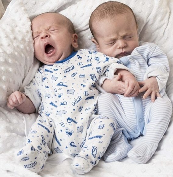 Imagem: bebe se uni a seu irmão 01 Recém-nascido segura firme as mãos do irmão gêmeo que iria passar por tratamento médico na Inglaterra