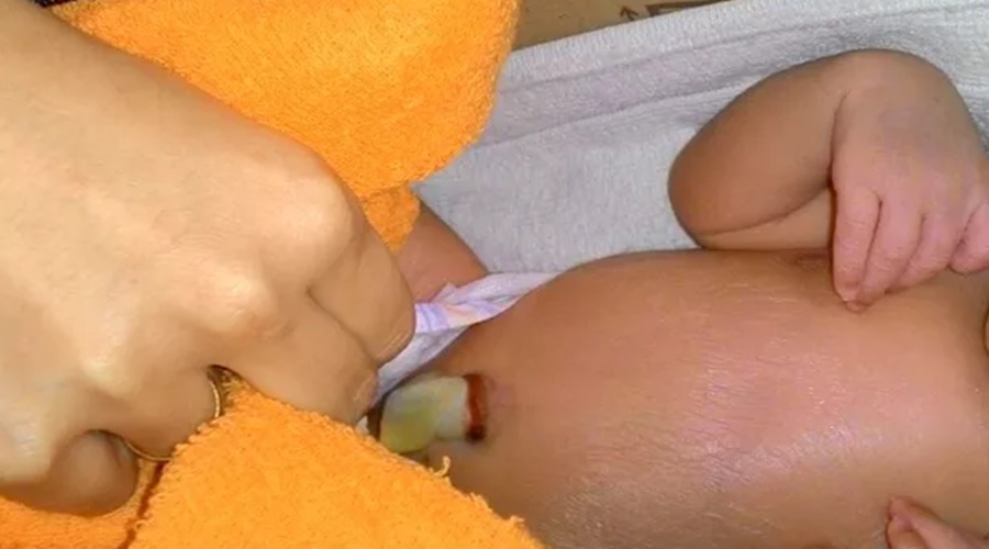 Imagem: bebê ainda estava com cordão umbilical