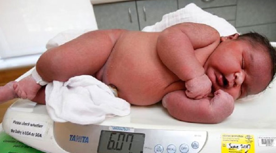 Imagem: bebê nasce com mais de 6 kilos