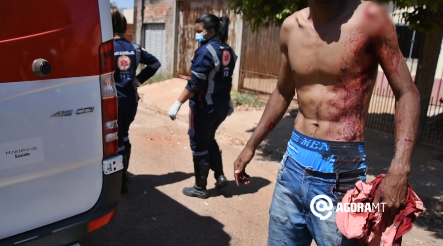 Imagem: Vitima alvejado por arma branca no Bairro Mathias Neves Após bebedeira, mulher esfaqueia o vizinho no ombro