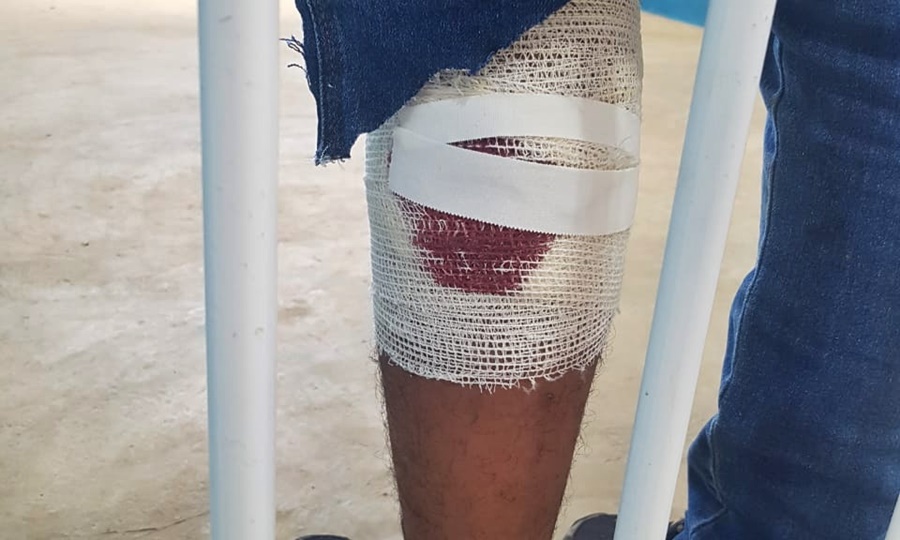 Imagem: ferido na perna Homem é preso após tentar ‘jogar’ drogas e celulares na Mata Grande