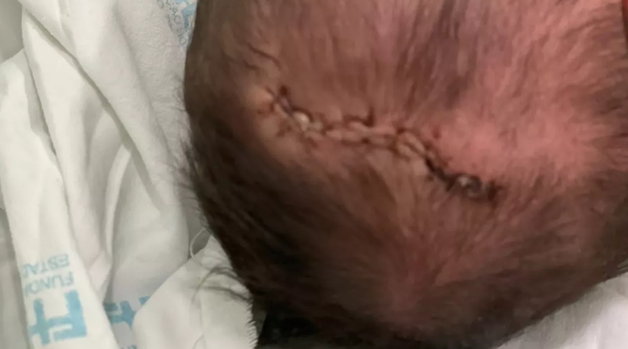 Imagem: A recem nascida teve traumatismo craniano Hospital terá que pagar por tratamento de bebê que caiu durante parto
