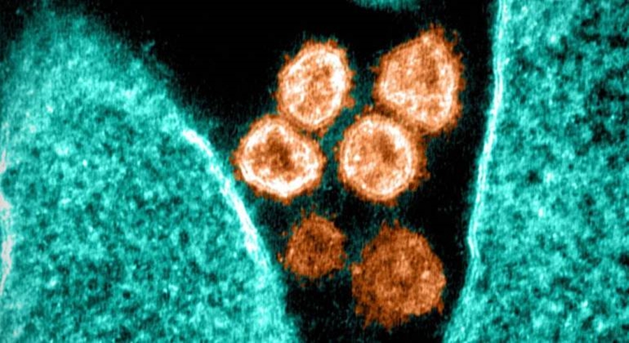 Imagem: sars cov 2 Cientistas descobrem método que impede totalmente a infecção pelo coronavírus