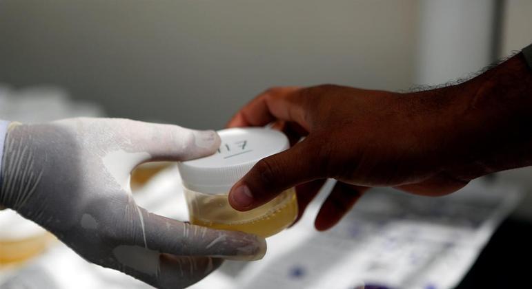 Imagem: teste anticorpos covid Covid: brasileiros criam teste de urina mais preciso que exame de sangue na detecção de anticorpos