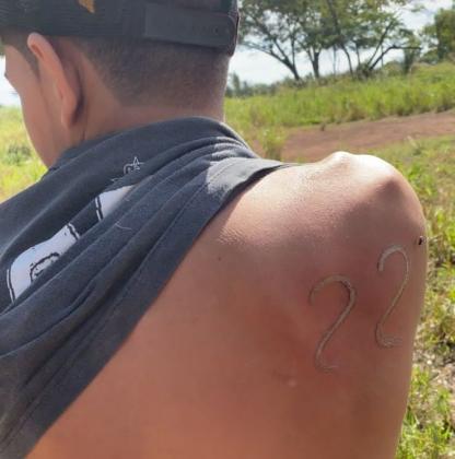 Imagem: ferro22 Adolescente marca a ferro quente número 22 nas costas em apoio a Bolsonaro