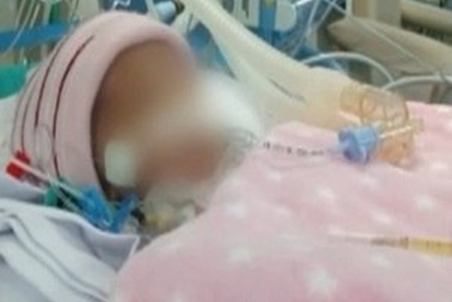 Imagem: BEBE Morre bebê de cinco dias que teria sido ferida na cabeça durante parto