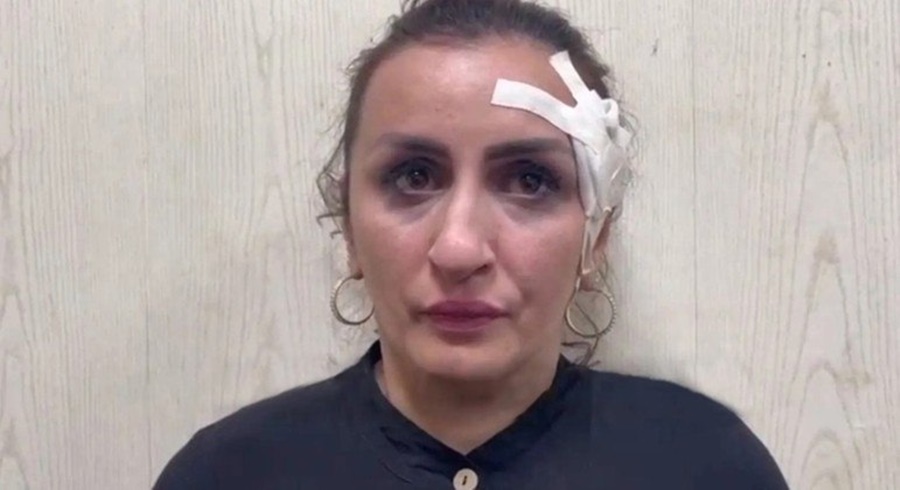 Imagem: MULHER PRESA Mãe é presa após vender bebê para pagar operação de R$ 19 mil no nariz