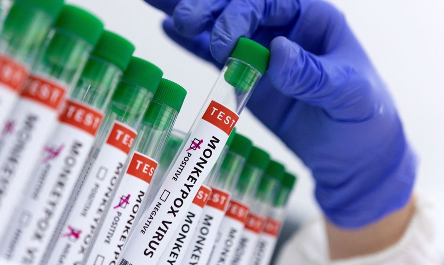 Ministerio de Ciencia invierte R$ 3 millones en investigación sobre viruela del simio