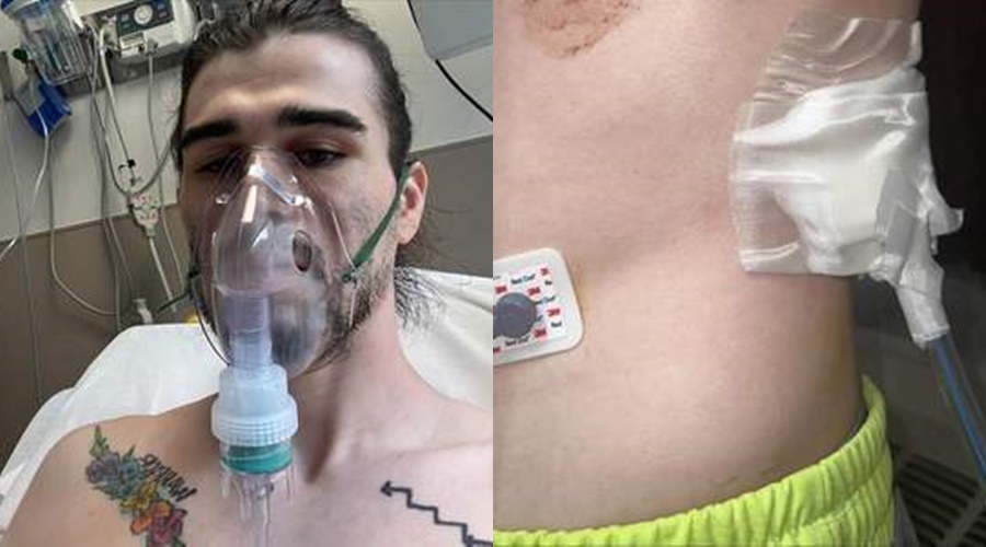 Image: VAPE NURSE Man has a punctured lung after excessive vaping